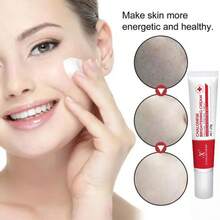 CHALONESE Brightening Cream Serum – 20g | Anti-Freckle, Dark Spot Removal & Skin Tone Correction | Herbal & Gentle Formula